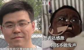 ¿Efecto COVID-19? El extraño cambio en el color de la piel de 2 médicos que sobrevivieron al coronavirus en Wuhan