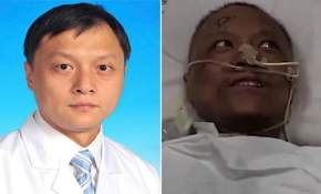 ¿Efecto COVID-19? El extraño cambio en el color de la piel de 2 médicos que sobrevivieron al coronavirus en Wuhan